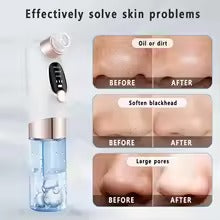 Black Head Removal USB Rechargeable